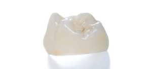 ジルコニアクラウン